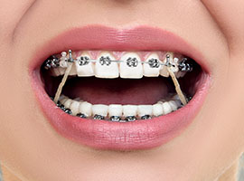 Elastics example