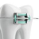 Brace band