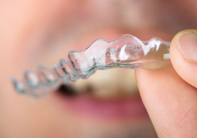 retainers retainers